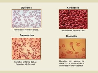 alteraciones-de-los-elementos-formes-sangu-neos-pdf