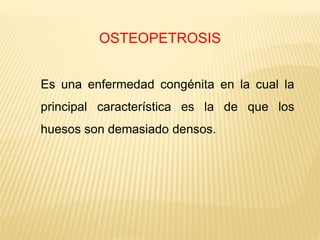 OSTEOPETROSIS
Es una enfermedad congénita en la cual la
principal característica es la de que los
huesos son demasiado densos.
 