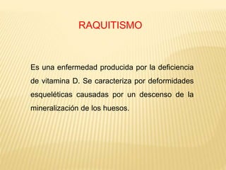 RAQUITISMO
Es una enfermedad producida por la deficiencia
de vitamina D. Se caracteriza por deformidades
esqueléticas causadas por un descenso de la
mineralización de los huesos.
 