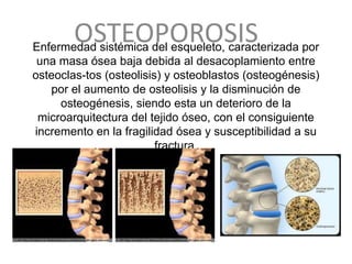 OSTEOPOROSIS
Enfermedad sistémica del esqueleto, caracterizada por
 una masa ósea baja debida al desacoplamiento entre
osteoclas-tos (osteolisis) y osteoblastos (osteogénesis)
   por el aumento de osteolisis y la disminución de
     osteogénesis, siendo esta un deterioro de la
 microarquitectura del tejido óseo, con el consiguiente
incremento en la fragilidad ósea y susceptibilidad a su
                         fractura.
 