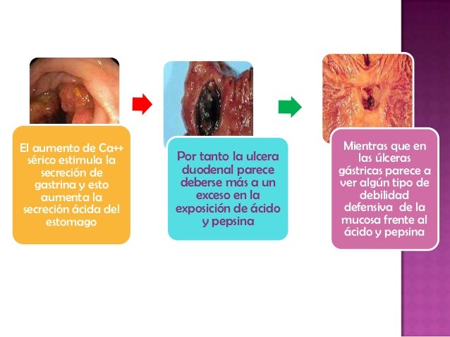 La oración que la persona ha dejado a beber