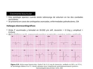 ALTERACIONES ELECTROCARDIOGRAFICAS _ BLOQUEO DE RAMAS | PPTX