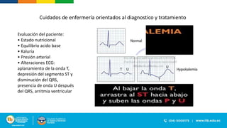 Evaluación del paciente:
• Estado nutricional
• Equilibrio acido base
• Kaluria
• Presión arterial
• Alteraciones ECG:
aplanamiento de la onda T,
depresión del segmento ST y
disminución del QRS,
presencia de onda U después
del QRS, arritmia ventricular
Cuidados de enfermería orientados al diagnostico y tratamiento
 