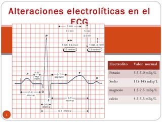 1
Alteraciones electrolíticas en el
ECG
Electrolito Valor normal
Potasio 3.5-5.0 mEq/L
Sodio 135-145 mEq/L
magnesio 1.5-2.5 mEq/L
calcio 4.5-5.5 mEq/L
 