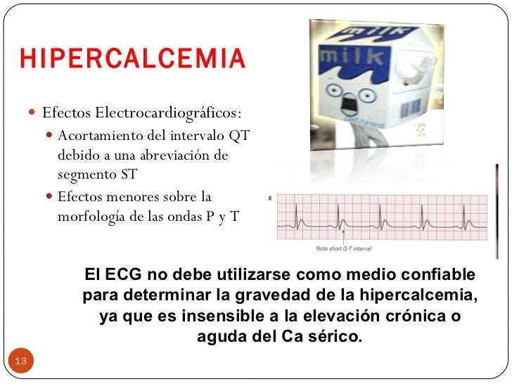 Alteraciones electrolíticas en el electrocardiograma