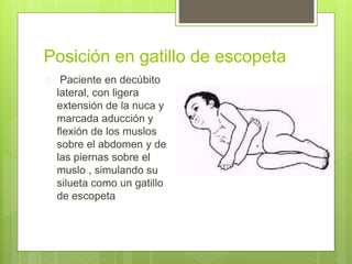 Posición en gatillo de escopeta
 Paciente en decúbito
lateral, con ligera
extensión de la nuca y
marcada aducción y
flexión de los muslos
sobre el abdomen y de
las piernas sobre el
muslo , simulando su
silueta como un gatillo
de escopeta
 