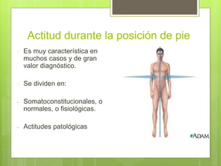 Actitud durante la posición de pie
 Es muy característica en
muchos casos y de gran
valor diagnóstico.
 Se dividen en:
- Somatoconstitucionales, o
normales, o fisiológicas.
- Actitudes patológicas
 