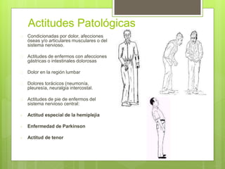 Actitudes Patológicas
 Condicionadas por dolor, afecciones
óseas y/o articulares musculares o del
sistema nervioso.
 Actitudes de enfermos con afecciones
gástricas o intestinales dolorosas
 Dolor en la región lumbar
 Dolores torácicos (neumonía,
pleuresía, neuralgia intercostal.
 Actitudes de pie de enfermos del
sistema nervioso central:
- Actitud especial de la hemiplejia
- Enfermedad de Parkinson
- Actitud de tenor
 