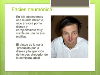 Facies neumónica
 En ella observamos
una mirada brillante,
algo ansiosa por la
disnea y
enrojecimiento muy
visible en una de sus
mejillas.
 El aleteo de la nariz
`producido por la
disnea y la aparición
de herpes alrededor de
la comisura labial
 