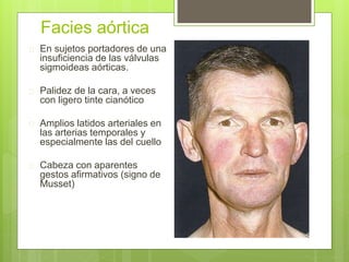 Facies aórtica
 En sujetos portadores de una
insuficiencia de las válvulas
sigmoideas aórticas.
 Palidez de la cara, a veces
con ligero tinte cianótico
 Amplios latidos arteriales en
las arterias temporales y
especialmente las del cuello
 Cabeza con aparentes
gestos afirmativos (signo de
Musset)
 