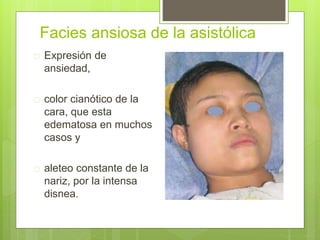 Facies ansiosa de la asistólica
 Expresión de
ansiedad,
 color cianótico de la
cara, que esta
edematosa en muchos
casos y
 aleteo constante de la
nariz, por la intensa
disnea.
 