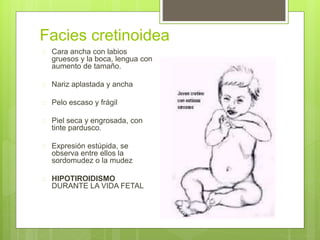 Facies cretinoidea
 Cara ancha con labios
gruesos y la boca, lengua con
aumento de tamaño.
 Nariz aplastada y ancha
 Pelo escaso y frágil
 Piel seca y engrosada, con
tinte pardusco.
 Expresión estúpida, se
observa entre ellos la
sordomudez o la mudez
 HIPOTIROIDISMO
DURANTE LA VIDA FETAL
 