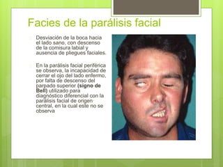 Facies de la parálisis facial
 Desviación de la boca hacia
el lado sano, con descenso
de la comisura labial y
ausencia de pliegues faciales.
 En la parálisis facial periférica
se observa, la incapacidad de
cerrar el ojo del lado enfermo,
por falta de descenso del
parpado superior (signo de
Bell) utilizado para
diagnóstico diferencial con la
parálisis facial de origen
central, en la cual este no se
observa
 