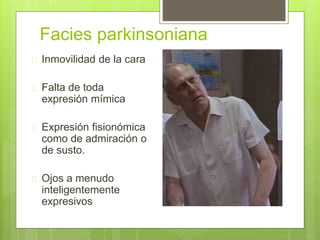 Facies parkinsoniana
 Inmovilidad de la cara
 Falta de toda
expresión mímica
 Expresión fisionómica
como de admiración o
de susto.
 Ojos a menudo
inteligentemente
expresivos
 