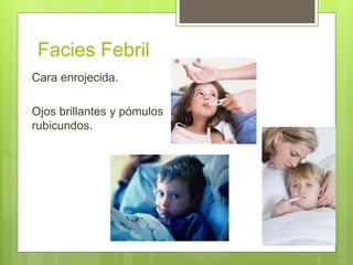 Facies Febril
 Cara enrojecida.
 Ojos brillantes y pómulos
rubicundos.
 