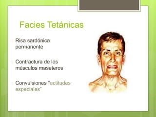 Facies Tetánicas
 Risa sardónica
permanente
 Contractura de los
músculos maseteros
 Convulsiones “actitudes
especiales”
 