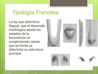 Tipología Francesa
 La ley que determina
Sigaud: que el desarrollo
morfológico desde los
estadios de la
fecundación el
conglomerado celular
que se forma ya
determina su estructura
principal
 