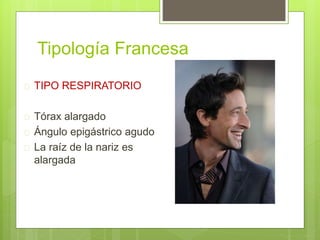 Tipología Francesa
 TIPO RESPIRATORIO
 Tórax alargado
 Ángulo epigástrico agudo
 La raíz de la nariz es
alargada
 
