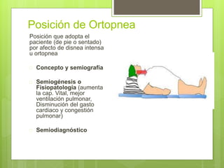 Posición de Ortopnea
Posición que adopta el
paciente (de pie o sentado)
por afecto de disnea intensa
u ortopnea
 Concepto y semiografía
 Semiogénesis o
Fisiopatología (aumenta
la cap. Vital, mejor
ventilación pulmonar,
Disminución del gasto
cardiaco y congestión
pulmonar)
 Semiodiagnóstico
 
