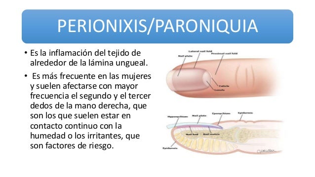 No puedo sanar el hongo sobre la cabeza