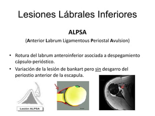 ALTERACIONES GELNOIDEAS .pptx