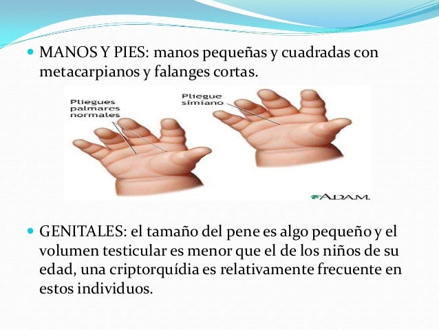 El miembro por la grasa parece pequeño