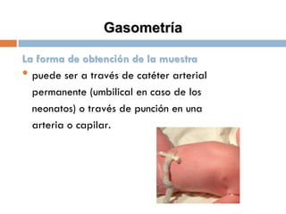 Gasometría
La forma de obtención de la muestra
• puede ser a través de catéter arterial
permanente (umbilical en caso de los
neonatos) o través de punción en una
arteria o capilar.

 