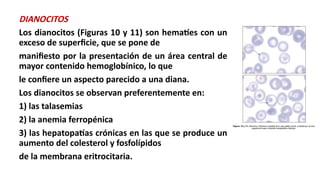 alteraciones-morfologicas-de-los-eritrocitos-ii-pptx