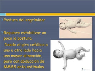    Postura del esgrimidor


   Requiere estabilizar un
    poco la postura.
    Desde el giro cefálico a
    uno u otro lado hacia
    una mayor alineación,
    pero con abducción de
    MMSS ante estímulos
 