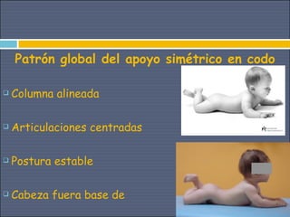 Patrón global del apoyo simétrico en codo

   Columna alineada

   Articulaciones centradas

   Postura estable

   Cabeza fuera base de
 