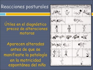 Reacciones posturales


 Útiles en el diagnóstico
  precoz de alteraciones
          motoras

  Aparecen alteradas
    antes de que se
 manifieste la patología
    en la motricidad
   espontánea del niño
 