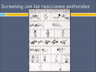 Screening con las reacciones posturales
 