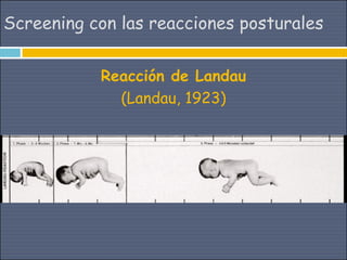 Screening con las reacciones posturales


           Reacción de Landau
             (Landau, 1923)
 