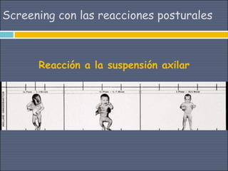 Screening con las reacciones posturales



      Reacción a la suspensión axilar
 