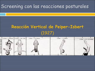 Screening con las reacciones posturales



    Reacción Vertical de Peiper-Isbert
                  (1927)
 