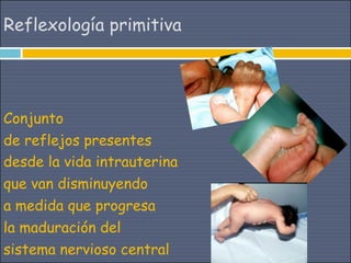 Reflexología primitiva




Conjunto
de reflejos presentes
desde la vida intrauterina
que van disminuyendo
a medida que progresa
la maduración del
sistema nervioso central
 