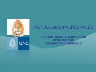 PATOLOGIAS PALPEBRALES

  DOCTOR JUAN IGNACIO ALONSO
        OFTALMOLOGO
    INSTRUCTOR QUIRURGICO
 