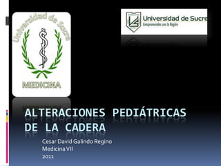 Alteraciones pediátricas  de la cadera Cesar David Galindo Regino Medicina VII 2011 