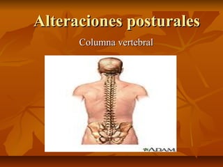Alteraciones posturales
Columna vertebral

 
