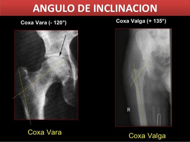 Al aumento del miembro de la casa