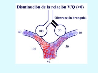 Disminución de la relación V/Q (>0)

                        Obstrucción bronquial



             100          50
40                                     40



                               50
       100



                   55
 