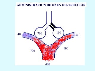 ADMINISTRACION DE O2 EN OBSTRUCCION




            700         100
40                                  40



                              100
      700



                  400
 