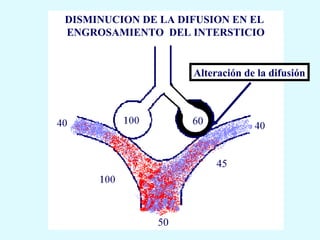 DISMINUCION DE LA DIFUSION EN EL
ENGROSAMIENTO DEL INTERSTICIO


                    Alteración de la difusión



                    60



                         45




              50
 