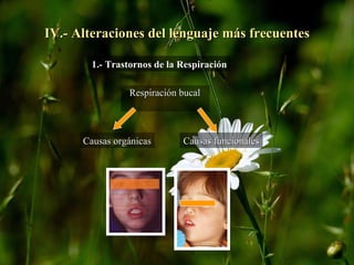 IV.- Alteraciones del lenguaje más frecuentes 1.- Trastornos de la Respiración Respiración bucal Causas orgánicas Causas funcionales 