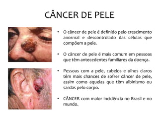 CÂNCER DE PELE
• O câncer de pele é definido pelo crescimento
anormal e descontrolado das células que
compõem a pele.
• O câncer de pele é mais comum em pessoas
que têm antecedentes familiares da doença.
• Pessoas com a pele, cabelos e olhos claros
têm mais chances de sofrer câncer de pele,
assim como aquelas que têm albinismo ou
sardas pelo corpo.
• CÂNCER com maior incidência no Brasil e no
mundo.
 