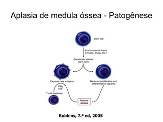 Aplasia de medula óssea - Patogênese




            Robbins, 7.ª ed, 2005
 
