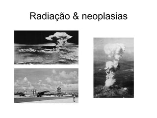 Radiação & neoplasias
 