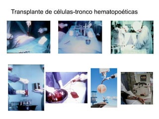 Transplante de células-tronco hematopoéticas
 