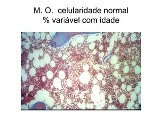 M. O. celularidade normal
  % variável com idade
 