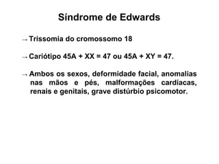 Síndrome de Edwards
→ Trissomia do cromossomo 18
→ Cariótipo 45A + XX = 47 ou 45A + XY = 47.
→ Ambos os sexos, deformidade facial, anomalias
nas mãos e pés, malformações cardíacas,
renais e genitais, grave distúrbio psicomotor.
 